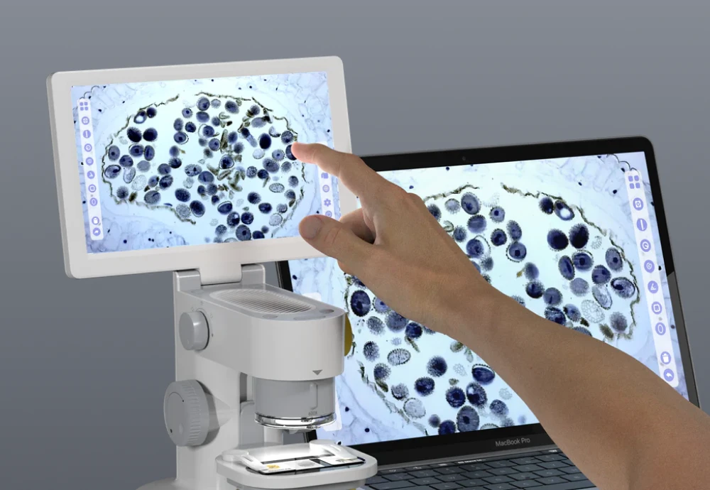 high resolution digital microscope camera